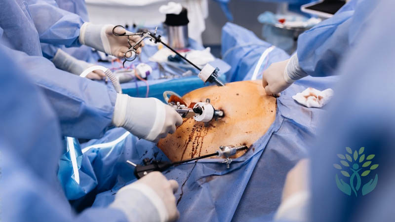 Laparoscopic Surgery